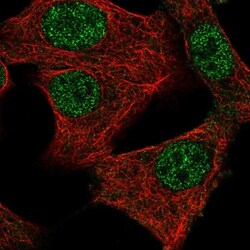 MED11 Antibody, Novus Biologicals 0.1mL; Unlabeled:Antibodies, Polyclonal